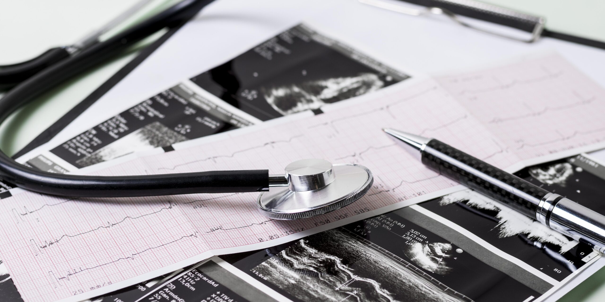 ECG Sakit Jantung Heart Attack